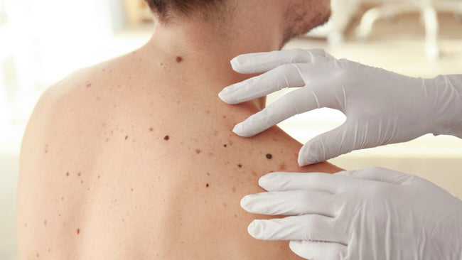 Skin Cancer Awareness Tips