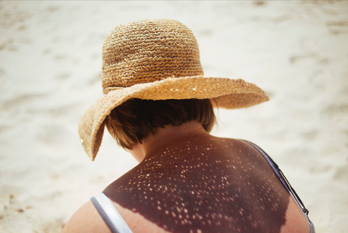 Sunscreen for Cancer Patients - Do’s & Don’ts